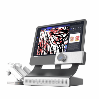 hair analyzer AI machine for scalp analysis