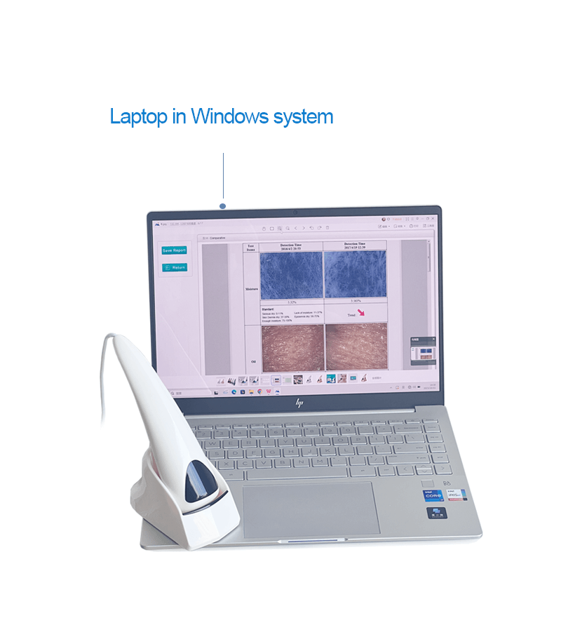USB skin analyzer
