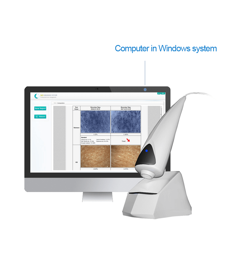 USB skin analysis