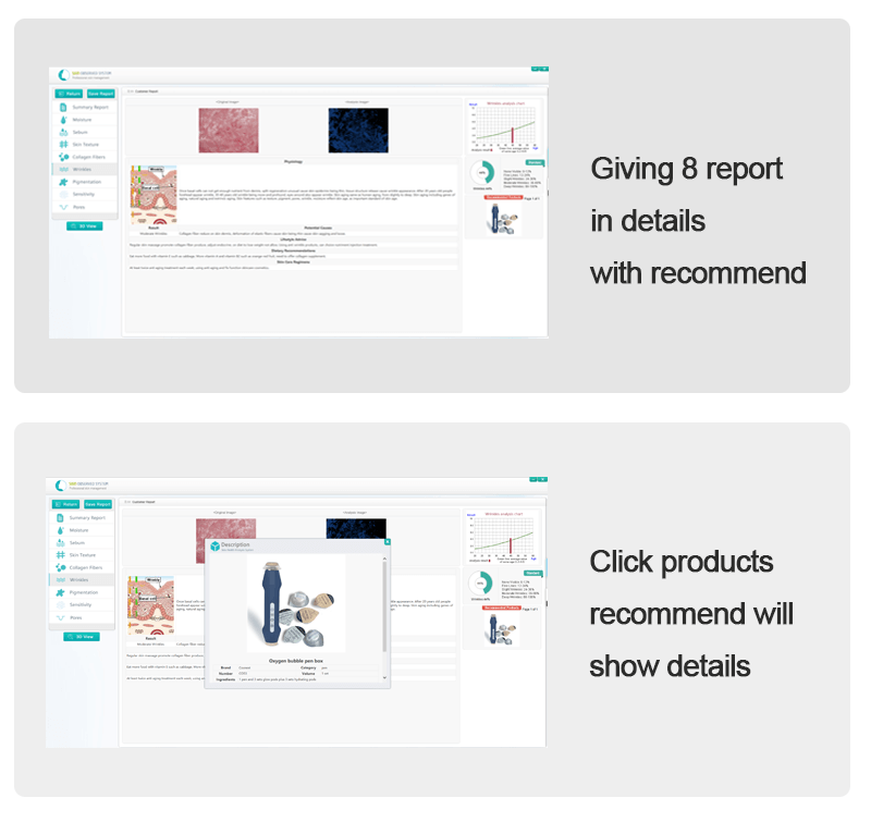 skin analyzer report