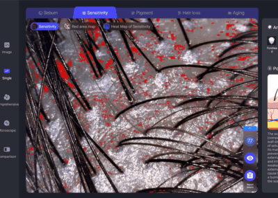 Different AI hair analyzer difference