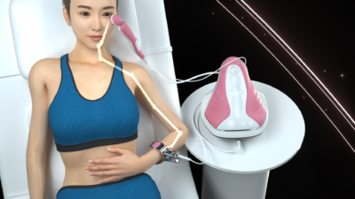 RF eyes wrinkle removal