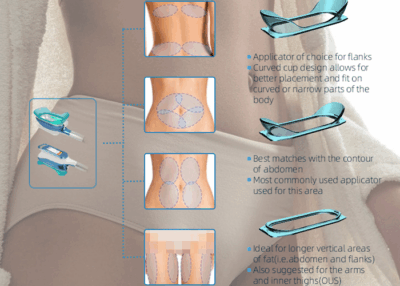 Body cavitation machine type