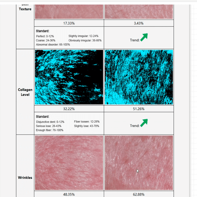 skin analyzer