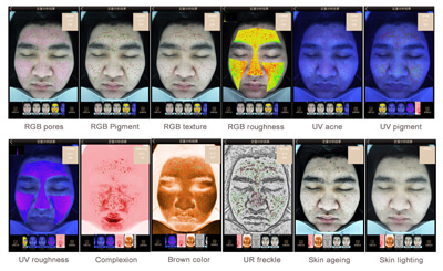 skin analyzer magic mirror