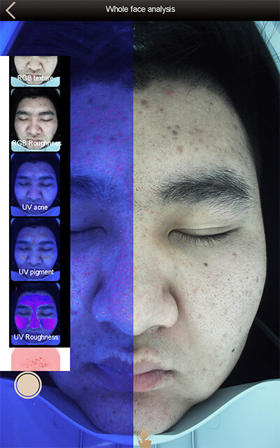 skin analyzer