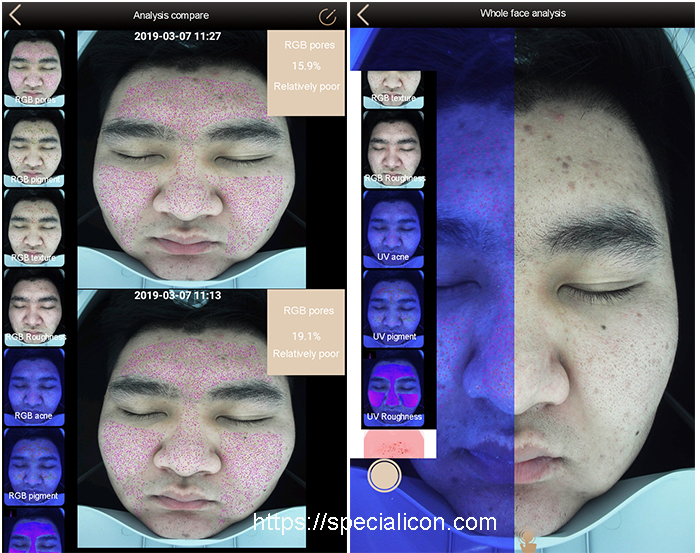 skin analyzer accuracy