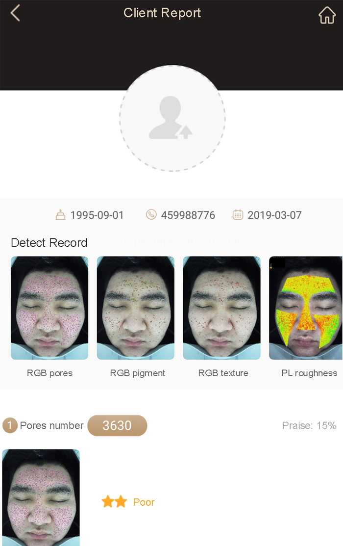 skin analyzer magic mirror