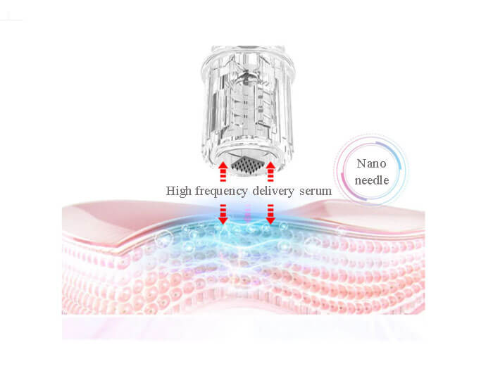 microneedling SA05