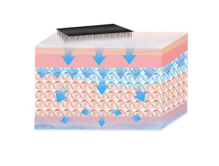derma roller