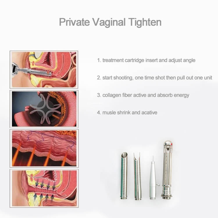 vaginal tighten laser machine