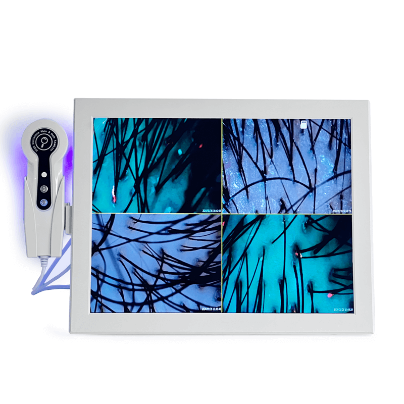 skin and scalp analyzer