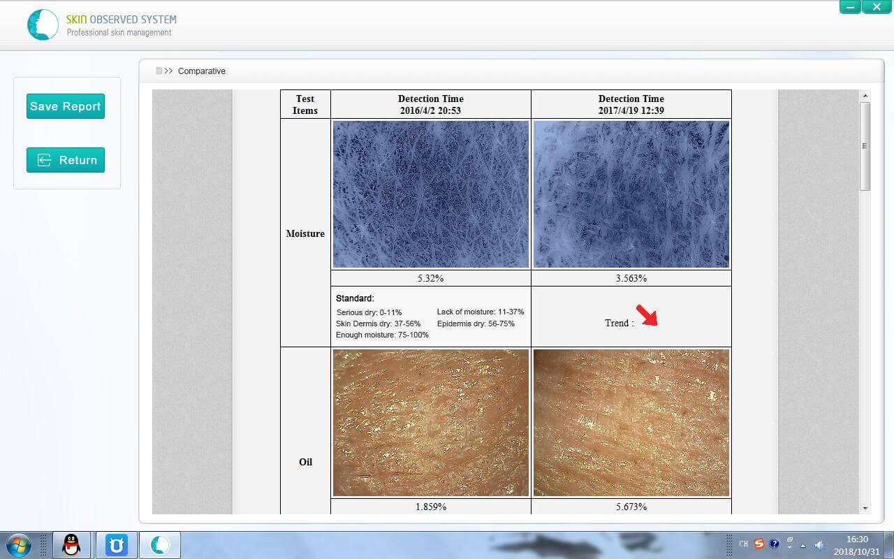 USB skin analysis machine