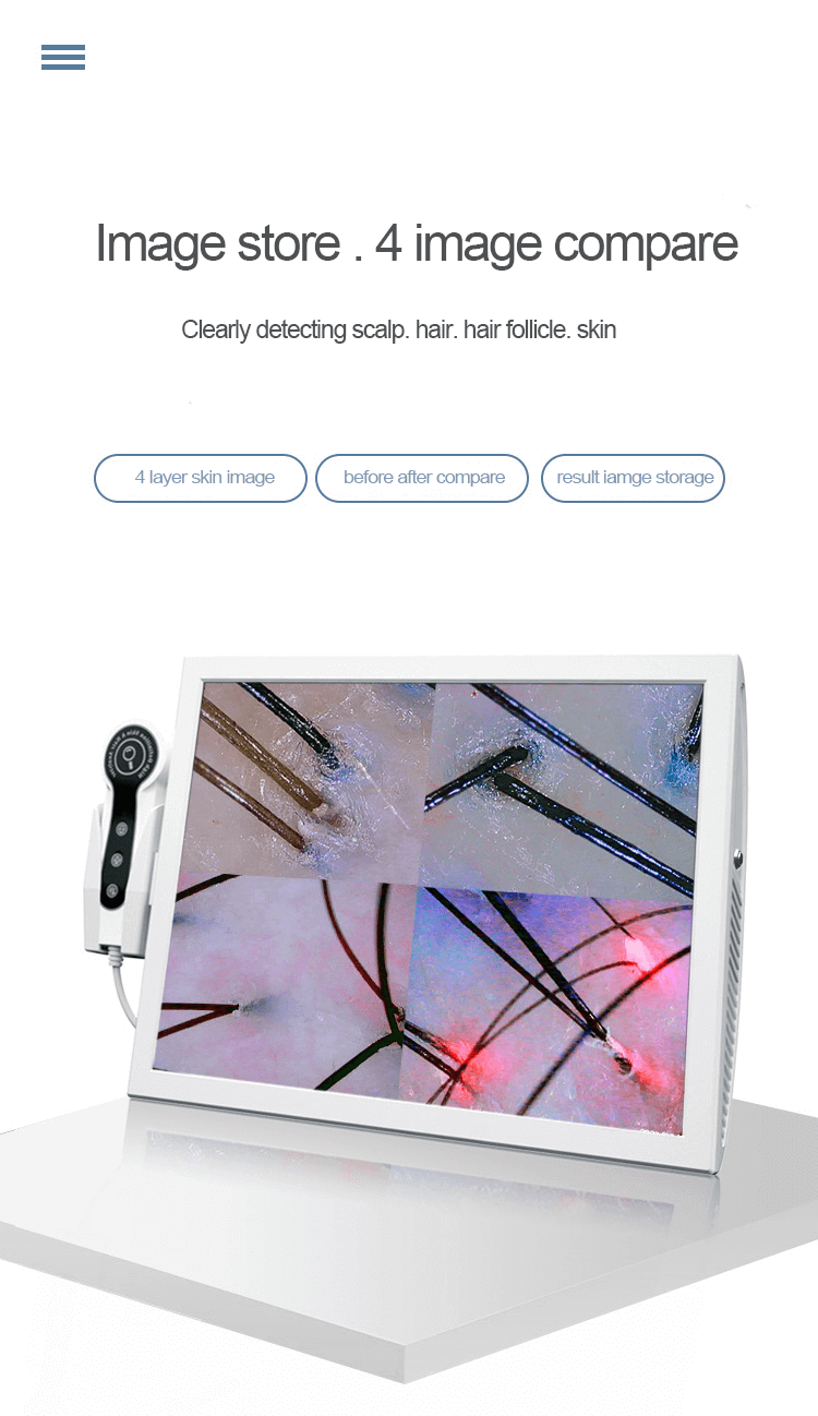 skin and scalp analyzer