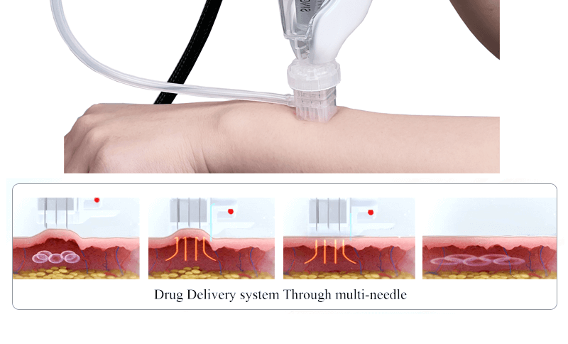 Mesotherapy gun injector machine with vacuum and 9pin needle work -  - 8