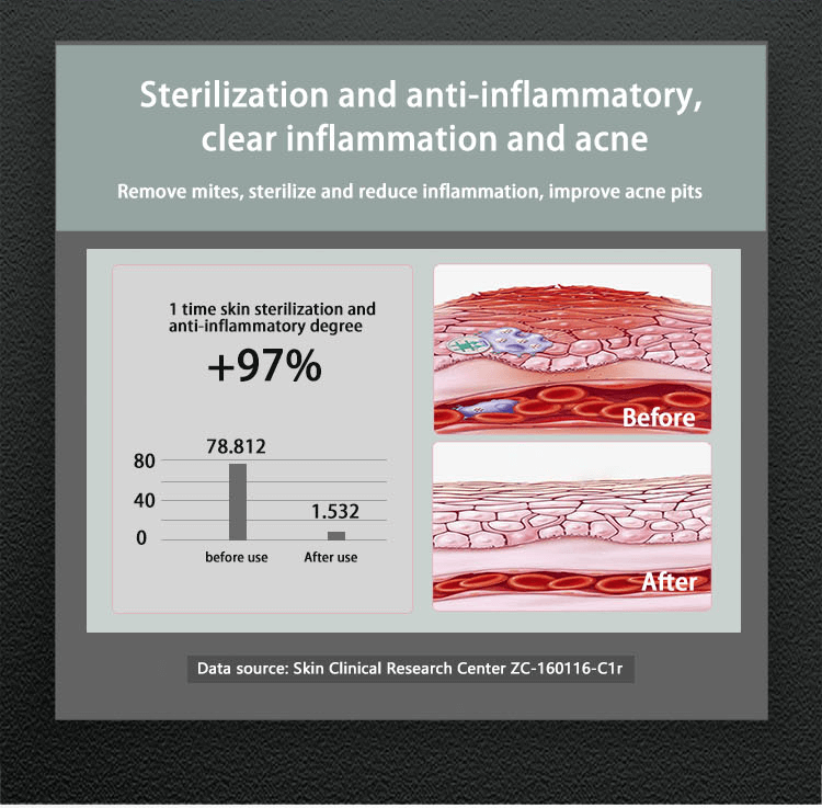 Hydrafacial with plasma ozone
