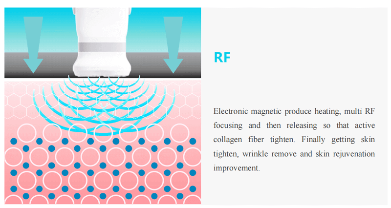 RF