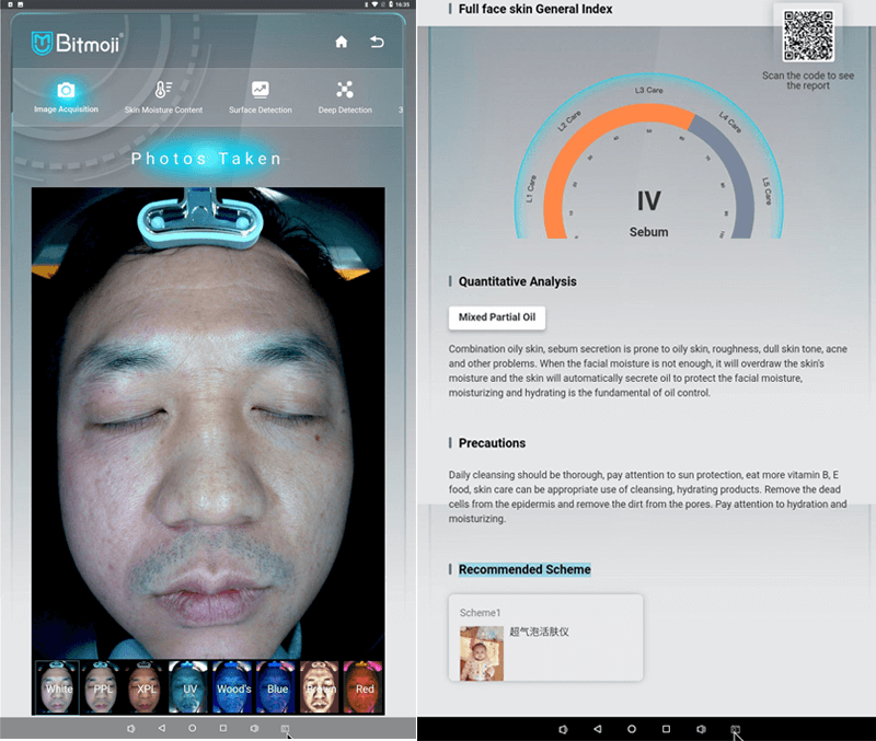 AI skin analysis machine