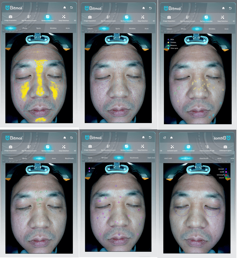 AI skin analyzer