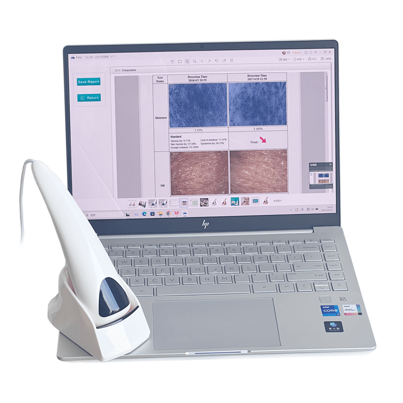 skin analyzer