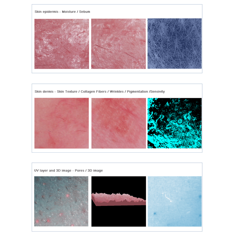 USB skin analysis