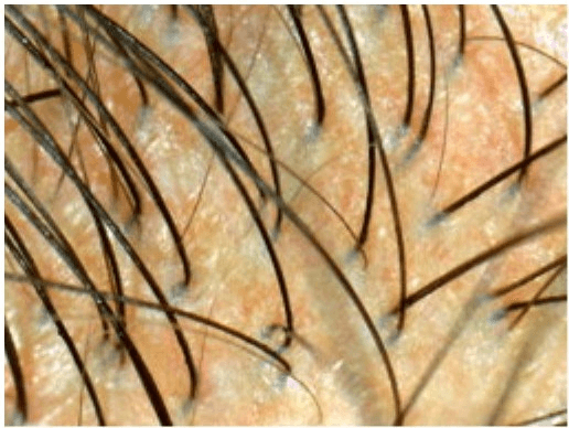 Hair texture