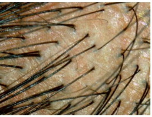 Texture