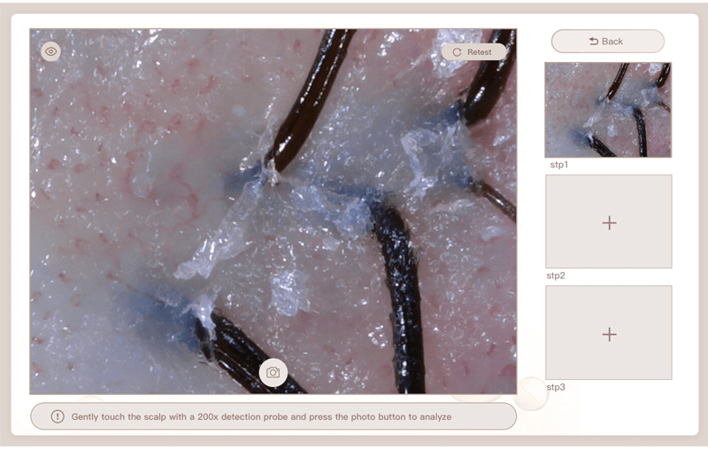 AI hair analyzer