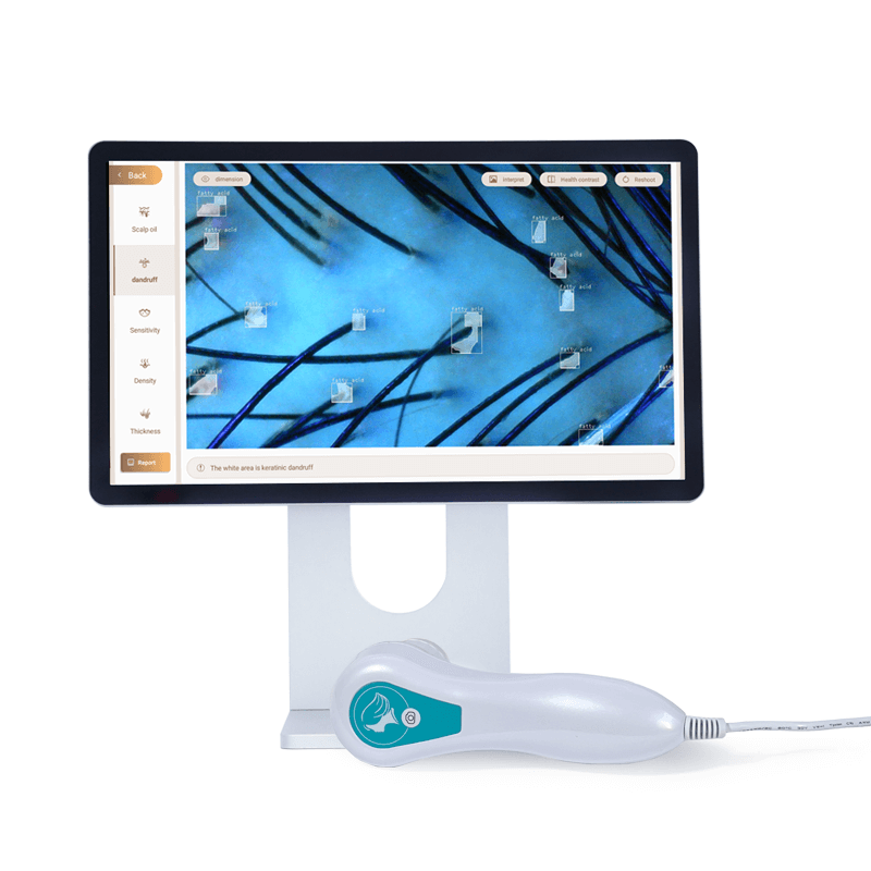 AI hair analyzer test item and application - News - 2