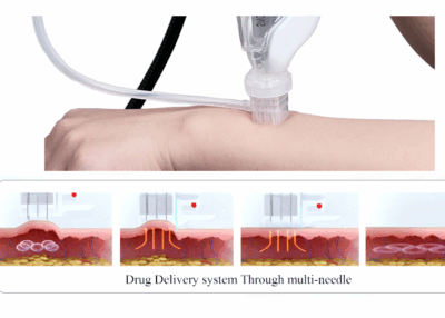mesotherapy gun benefits